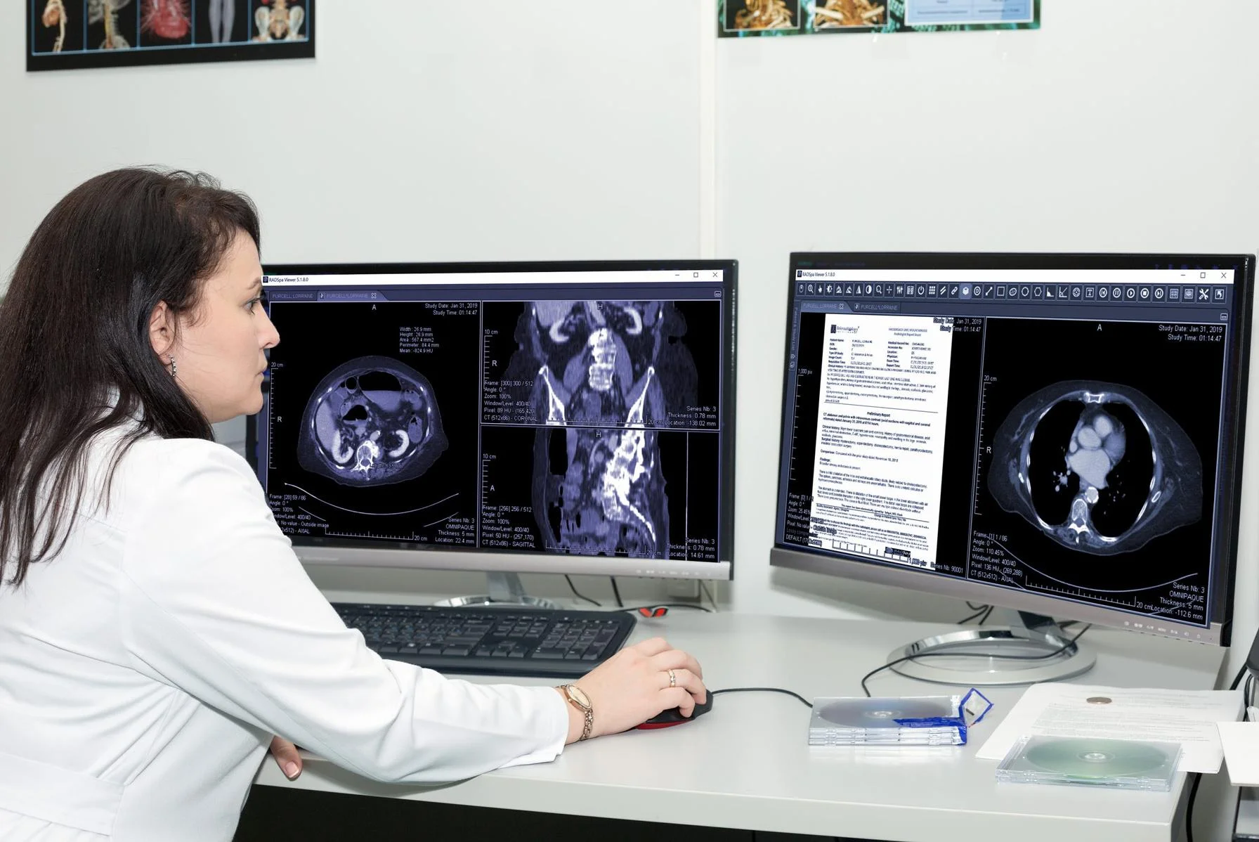 PACS Redefined: SEPStream's Affordable and Cutting-Edge Radiology Solutions